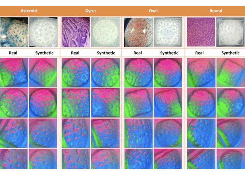 Imágenes sintéticas generadas por cada modelo de difusión contrastadas con las imágenes texturales reales correspondientes de cuatro tipos de pólipos (foto cortesía de UT en Austin)