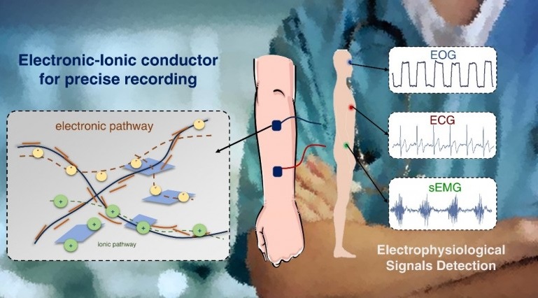 Imagen: Estructura de material de electrodos de película compuesta y utilizado para el monitoreo de la señal del cuerpo (foto cortesía de Wearable Electronics))