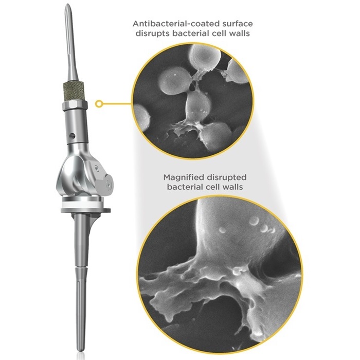 Imagen: la tecnología antibacteriana NanoCept (foto cortesía de Onkos Surgical)