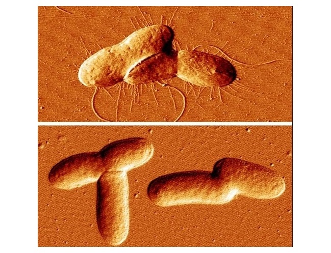 Las imágenes de microscopía de cepas bacterianas muestran una (arriba) que produce fimbrias de manera normal y otra con un alto nivel de MEcPP que no puede producir fimbrias (Foto cortesía de Jingzhe Guo/UCR)