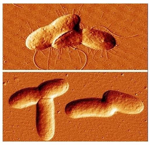 Las imágenes de microscopía de cepas bacterianas muestran una (arriba) que produce fimbrias de manera normal y otra con un alto nivel de MEcPP que no puede producir fimbrias (Foto cortesía de Jingzhe Guo/UCR)