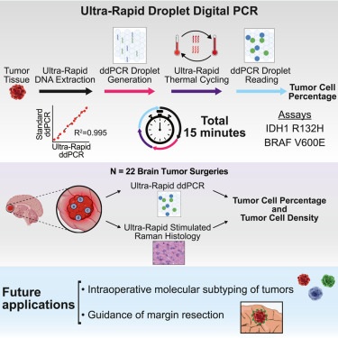 Imagen: La nueva herramienta puede ayudar a los cirujanos a determinar rápidamente qué células son cancerosas y cuántas de esas células están presentes en una muestra de tejido particular (foto cortesía de Med online, DOI: 10.1016/j.medj.2025.100604)