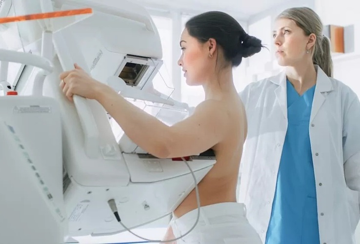 Imagen:  la IA puede identificar de forma más temprana los tipos de cáncer de intervalo “visibles mediante mamografía” al marcarlos en el momento de la detección (Foto cortesía de ScreenPoint Medical)