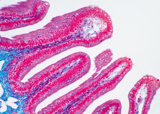 Imagen: una vista microscópica del intestino grueso muestra el revestimiento de microvilli que inspiró la estructura protectora del biosensor Sensbit (foto cortesía de Shutterstock)