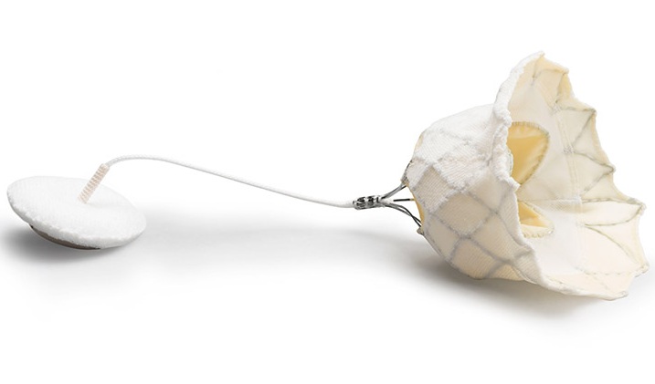 Imagen: El sistema Tendyne TMVR está aprobado por la FDA de EUA para tratar a personas con enfermedad de la válvula mitral (foto cortesía de Abbott)