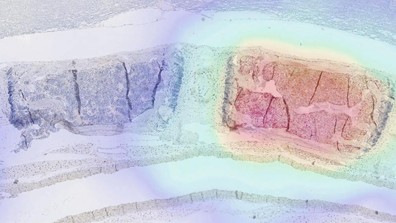Imagen: el nuevo método permite visualizar las células CAR T que atacan el tejido tumoral en el cuerpo mediante imágenes PET (foto cortesía de Volker Morath/TUM)