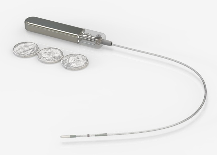 Imagen: el sistema CBGM totalmente implantable puede hacer que el control de la glucosa sea menos engorroso (foto cortesía de Glucotrack)