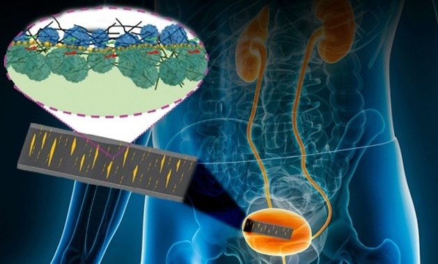 Imagen: el sensor similar a la piel monitorea el movimiento interno y externo del cuerpo y las señales eléctricas (foto cortesía de Huanyu “Larry” Cheng and Jennifer M. McCann)