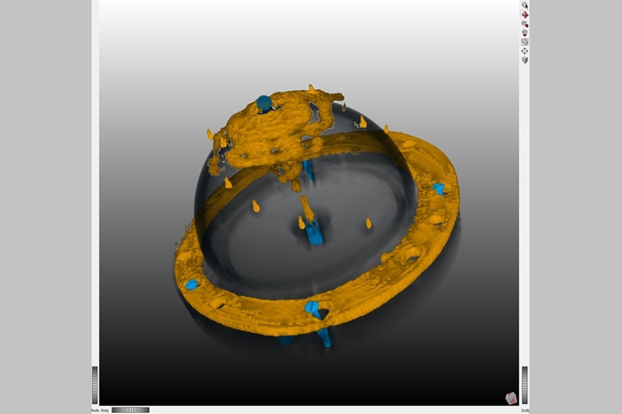 Imagen: conjunto de datos registrados que combinan datos de radar y rayos X del fantasma de la superficie del pecho (foto cortesía de Fraunhofer MEVIS) Imagen: conjunto de datos registrados que combinan datos de radar y rayos X del fantasma de la superficie del pecho (foto cortesía de Fraunhofer MEVIS)