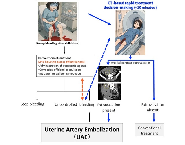 Imagen: la TC dinámica permite una detección más temprana y precisa de pacientes que requieren embolización de la arteria uterina (foto cortesía de Yamaguchi et al.) Imagen: la TC dinámica permite una detección más temprana y precisa de pacientes que requieren embolización de la arteria uterina (foto cortesía de Yamaguchi et al.)