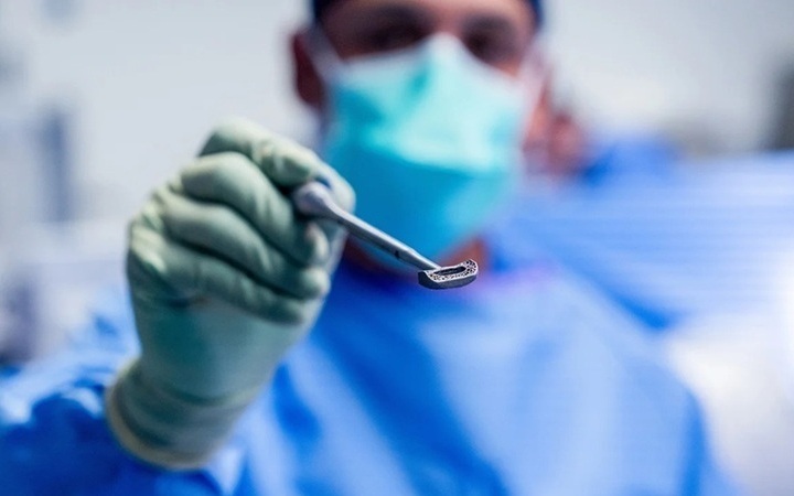 Imagen: el implante de titanio diseñado a medida, fabricado según la anatomía espinal única de cada paciente (Foto cortesía de Justin Covington/UC San Diego Health)