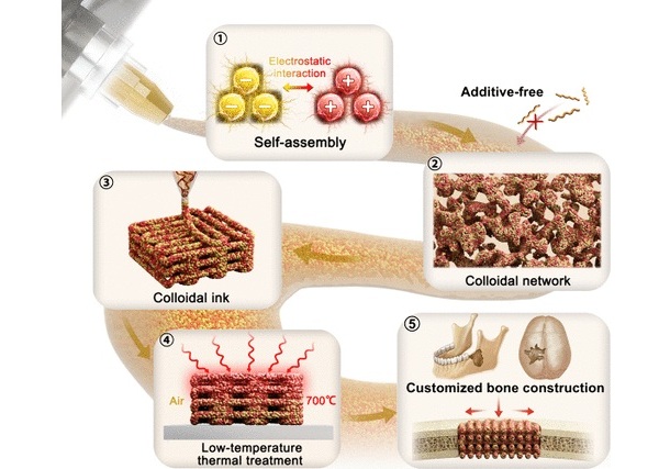 Imagen: el vidrio bioactivo imprimible en 3D podría usarse como sustituto óseo (ACS Nano 2025, DOI:10.1021/acsnano.5c06377)