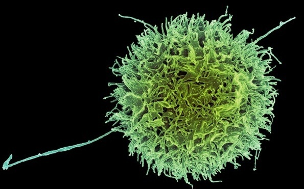 Imagen: El estudio identificó modificaciones genéticas que hacen que las células asesinas naturales sean más efectivas para destruir células cancerosas (Foto cortesía del NIAID)