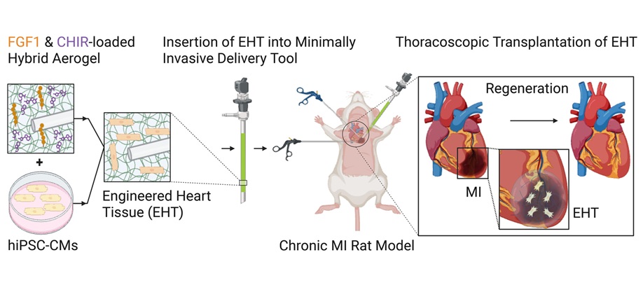 Imagen: la administración mínimamente invasiva de tejidos cardíacos modificados restaura la función cardíaca en ratas con infarto de miocardio crónico (P Li et al., Acta Biomaterialia (2025). doi.org/10.1016/j.actbio.2025.08.057)
