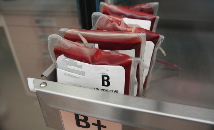 Imagen: Realizar transfusiones de sangre más pronto después de una cirugía mayor puede ayudar a proteger el corazón (Fotografía cortesía de American Heart Association)