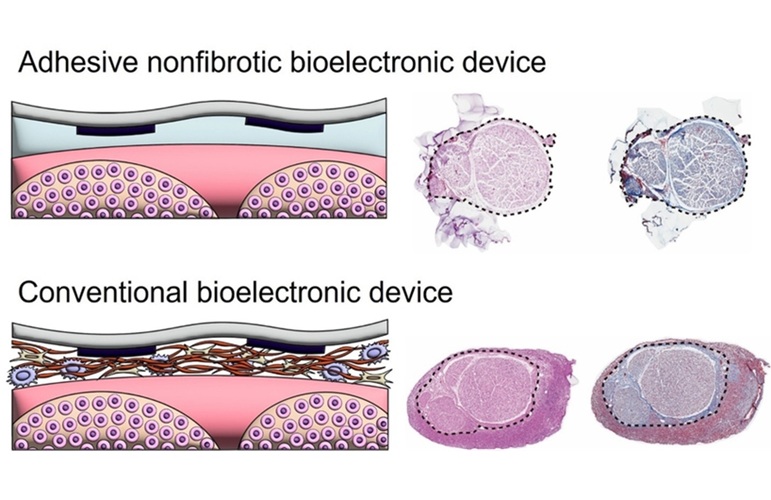 Imagen: Inspirado en la acupuntura tradicional, este enfoque tiene el potencial de impactar a todos los dispositivos bioelectrónicos implantables (Fotografía cortesía de Hyunmin Moon, et al./MIT)
