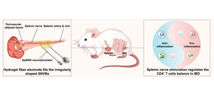 Ilustración esquemática del tratamiento electrofarmacéutico de la enfermedad inflamatoria intestinal (EII) mediante la estimulación inalámbrica del nervio esplénico con tecnología SpNWS (Fotografía cortesía de Science China Press)