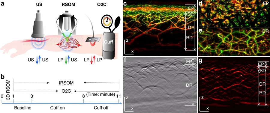 Imagen: procedimiento fRSOM para evaluar la función endotelial de la microvasculatura de la piel (He, H., Karlas, A., Fasoula, NA. et al. Light Sci Appl (2026). doi.org/10.1038/s41377-025-02103-6)