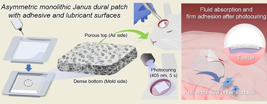 Imagen: los parches Janus activados por la luz también tienen un gran potencial para diversas aplicaciones más allá de la neurocirugía (Kang, et al. Chemical Engineering Journal, 2026; DOI: 10.1016/j.cej.2025.171881)