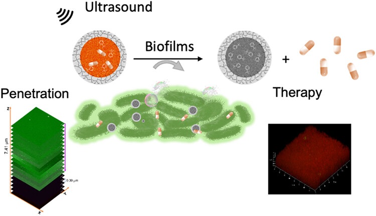 Imagen: las nanopartículas activadas por ultrasonido liberan antibióticos directamente dentro de las biopelículas bacterianas (Odyniec, M. L. et al., JACS Au (2026). DOI: 10.1021/jacsau.5c01711)