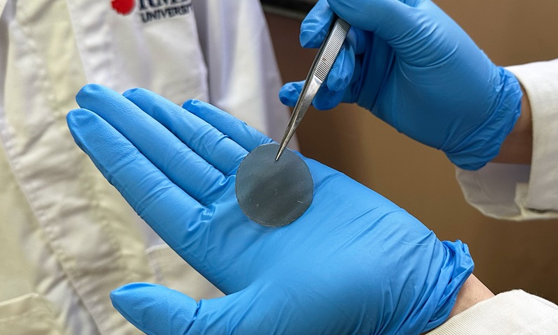 Imagen: la doble función del parche inteligente para heridas podría respaldar una intervención más oportuna y eficaz por parte de los médicos. (Foto cortesía de la Universidad RMIT)