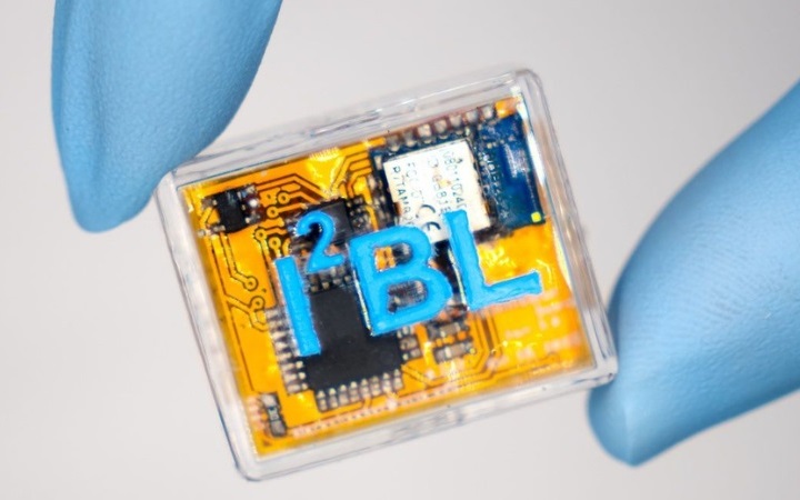 Imagen: el nuevo sensor de microagujas proporciona una monitorización continua y mínimamente invasiva de la piel (fotografía cortesía de Emaminejad Lab/UCLA)