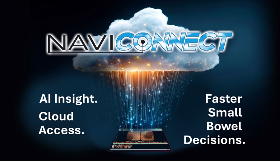 Imagen: NaviCONNECT proporciona acceso seguro basado en la nube a estudios e informes de cápsulas endoscópicas, lo que permite a los médicos recuperar e interpretar estudios desde prácticamente cualquier ubicación (Fotografía cortesía de AnX Robotica)