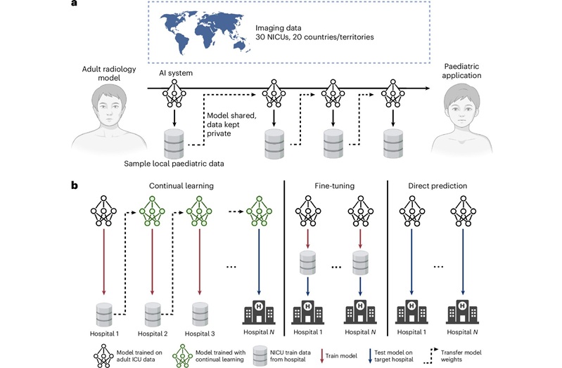 Imagen: Resumen del paradigma de aprendizaje continuo y comparaciones de puntos de referencia. (Rao, V.M., Chen, E., Saenz, A. et al. Repurposing adult AI radiograph models for neonatal care through continual learning: an international multicentre study. Nat. Biomed. Eng (2026). https://doi.org/10.1038/s41551-026-01812-6) Imagen: Resumen del paradigma de aprendizaje continuo y comparaciones de puntos de referencia. (Rao, V.M., Chen, E., Saenz, A. et al. Repurposing adult AI radiograph models for neonatal care through continual learning: an international multicentre study. Nat. Biomed. Eng (2026). https://doi.org/10.1038/s41551-026-01812-6)