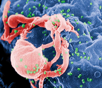 Imagen: Microfotografía electrónica de barrido (SEM) de la gemación del virus de inmunodeficiencia humana 1 (VIH-1) (en verde) en un linfocitos cultivado (Fotografía cortesía de C. Goldsmith).
