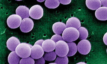 Imagen: Microfotografía electrónica de barrido la bacteria Staphylococcus aureus, coagulasa negativa (Fotografía cortesía de Janice Haney Carr).