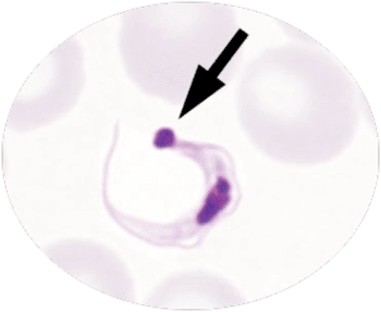 Imagen: Fotomicrografía del parásito protozoario Trypanosoma cruzi en un frotis delgado de sangre (Fotografía cortesía del CDC - Centros para el Control y Prevención de las Enfermedades).