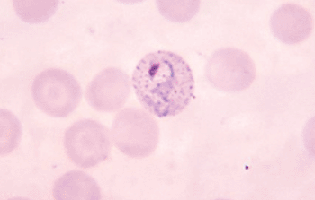 Imagen: Fotomicrografía que muestra un trofozoito en crecimiento de Plasmodium vivax en un frotis de sangre (Fotografía cortesía de los CDC – Centros para el Control y la Prevención de las Enfermedades de los EUA).