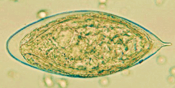 Imagen: Huevo de Schistosoma haematobium en un montaje en fresco de orina concentrada mostrando la espina terminal característica (Fotografía cortesía de los Centros para el Control y Prevención de las Enfermedades).