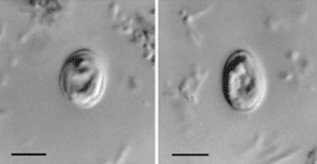 Imagen A: Fotomicrofotografías de contraste de interferencia Nomarski de Cryptosporidium muris de las heces de un humano positivo para el VIH. Barras de escala = cinco micras (Fotografía cortesía del CDC).