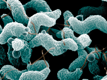Imagen: Microfotografía electrónica de barrido de Campylobacter jejuni (Fotografía cortesía de Jonas Waldenström).