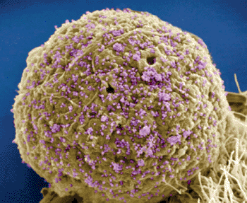 Imagen: Microfotografía electrónica de barrido de los virus de inmunodeficiencia humana unidos a una célula T CD4 humana (Fotografía cortesía de Thomas Deerinck).