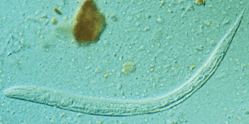 Imagen: Larva del parásito nematodo, Strongyloides stercoralis (Fotografía cortesía de los Centros para el Control y Prevención de las Enfermedades).