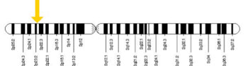 Imagen: El gen ALK está localizado en el brazo corto (p) del cromosoma 2 en la posición 23 (Fotografía cortesía de los Institutos Nacionales de Salud de los EUA).