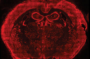 Imagen: Los ARNs están marcados de rojo en el cerebro del ratón (Fotografía cortesía de la Facultad de Medicina de Harvard y el Instituto Wyss).