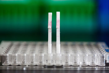 Imagen: Una novedosa prueba en tira de orina revela la presencia de las proteinasas asociadas con el cáncer (Fotografía cortesía de Bryce Vickmark y el MIT).