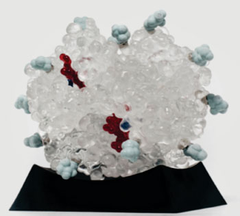Imagen: Modelo de una molécula de hemoglobina glicosilada (HbA1c) Fotografía cortesía de Molecular Models).