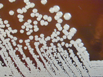 Imagen. La bacteria aeróbica, Gram-negativa, Burkholderia pseudomallei, después de un crecimiento durante 96 horas en agar con sangre de cordero (Fotografía cortesía de Larry Stauffer).