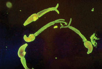 Imagen: Cercarias de Schistosoma mansoni teñidas mediante un colorante de inmunofluorescencia indirecta (Fotografía cortesía del Dr. Alexander Sulzer).