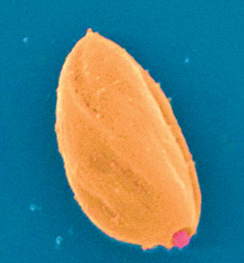 Imagen: Microfotografía electrónica de barrido a color (SEM) de amastigotes de Leishmania mexicana (Fotografía cortesía de Zephyris).