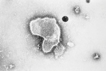 Imagen B: Microfotografía electrónica del virus sincitial respiratorio (VSR). El virión tiene un tamaño y formas, variables (Fotografía cortesía de E. L. Palmer).