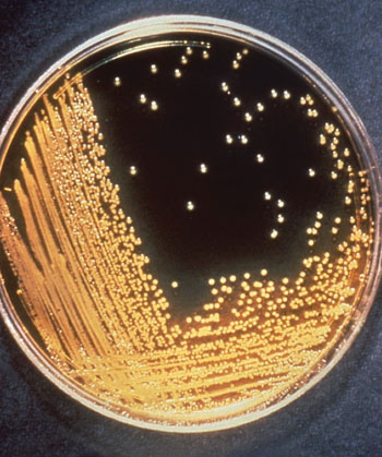 Imagen: Colonias bacterianas de Vibrio cholerae cultivadas en el medio agar Tiosulfato-Citrato-Bilis-Sacarosa (TCBS) (Fotografía cortesía del CBC).