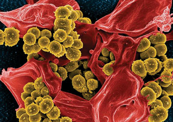 Imagen: Microfotografía electrónica de barrido (SEM) del Staphylococcus aureus resistente a la meticilina y un neutrófilo humano muerto (Fotografía cortesía del Instituto Nacional de Alergia y Enfermedades Infecciosas de los EUA)