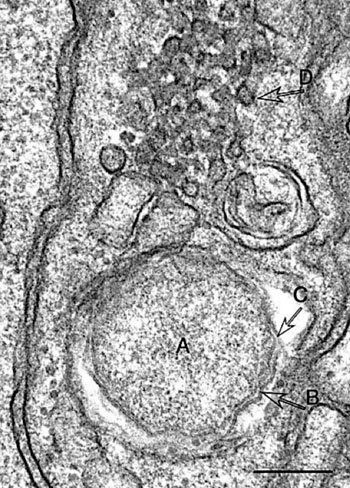 Imagen: Microfotografía electrónica de transmisión (TEM) de Candidatus Neoehrlichia mikurensis (A).  Las flechas indican la membrana exterior ondulada, de dos hojas, que es característica de la bacteria (B), el espacio irregular, estrecho periplásmico entre las membranas interior y exterior, que también es característico (C) y el sistema canalicular de la célula endotelial (D) (Fotografía cortesía de Yasuko Rikihisa).