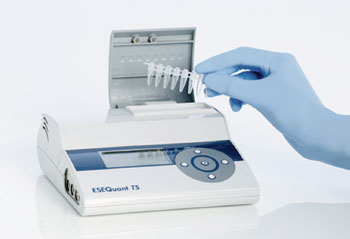 Imagen B: El escáner de tubos ESEQuant para la medición de fluorescencia en tubos para las aplicaciones en los puntos-de-necesidad (Fotografía cortesía de Qiagen).