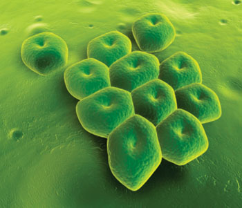 Imagen: Microfotografía electrónica de barrido (SEM) de Acinetobacter baumannii, un bacilo Gram-negativo, aerobio, no fermentador, multi-resistente a los medicamentos (Fotografía cortesía de Bioquell).